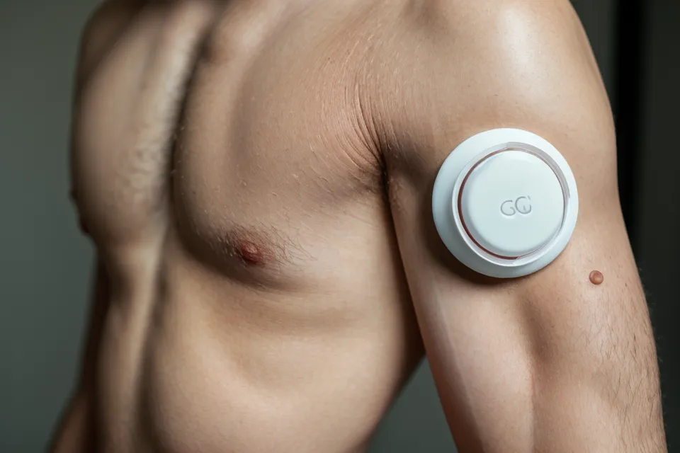 Continuous glucose monitor sensor worn on the arm for ongoing health data tracking